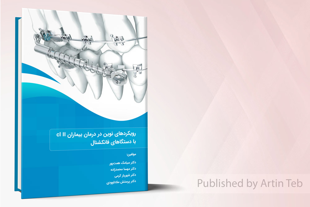 رویکردهای نوین در درمان بیماران cl II با دستگاه های فانکشنال